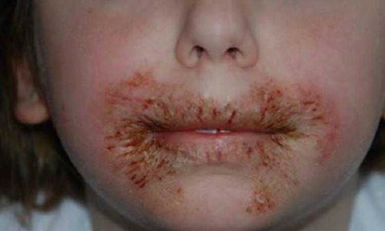Les médecins mettent en garde: Ne jamais nettoyer le visage d’un enfant avec des lingettes