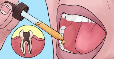 Votre dentiste ne vous parlera pas de ces remèdes naturels contre les maux de dents