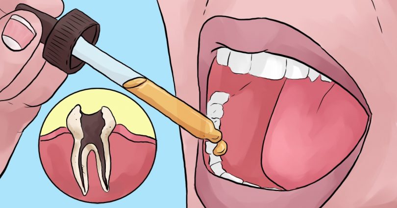 Votre dentiste ne vous parlera pas de ces remèdes naturels contre les maux de dents